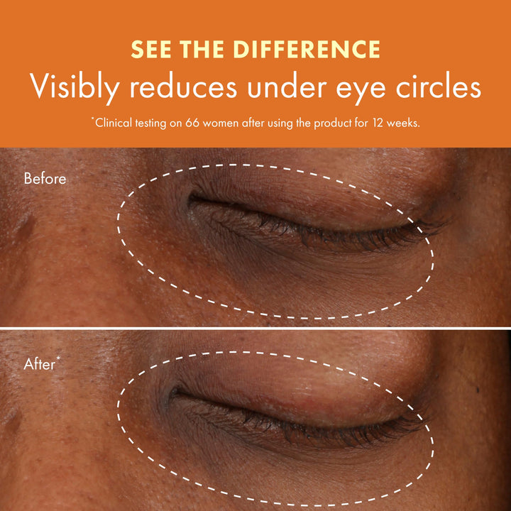 15 ml lightweight brightening eye cream tube, warm illuminating shade